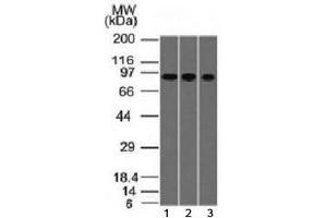 Western blot testing of human 1) A549, 2) HepG2 and 3) HCT-116 cell lysate with Villin antibody (clone VIL1/1314). (Villin 1 抗体  (AA 179-311))