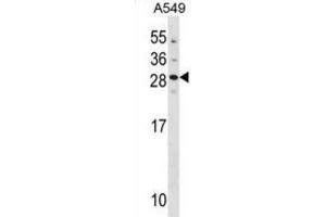Western Blotting (WB) image for anti-Guanylate Cyclase Activator 1B (Retina) (GUCA1B) antibody (ABIN3000950) (GUCA1B 抗体)