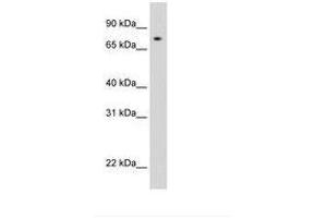 Image no. 1 for anti-Signal Transducer and Activator of Transcription 1, 91kDa (STAT1) (AA 259-308) antibody (ABIN6736289) (STAT1 抗体  (AA 259-308))