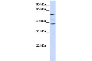SLC25A16 antibody used at 1 ug/ml to detect target protein. (SLC25A16 抗体)