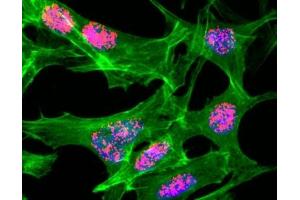 ICC/IF staining of HeLa cells treated with sodium butyrate using recombinant H3K23ac antibody (red).