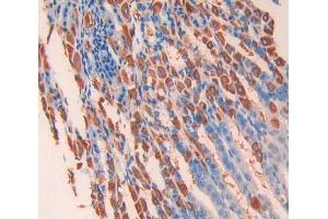 IHC-P analysis of stomach tissue, with DAB staining. (IL13 Receptor alpha 1 抗体  (AA 28-171))