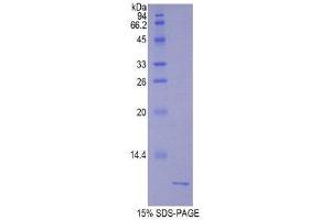 SDS-PAGE (SDS) image for Urocortin 2 (UCN2) (AA 23-107) protein (His tag) (ABIN1878182) (Urocortin 2 Protein (UCN2) (AA 23-107) (His tag))