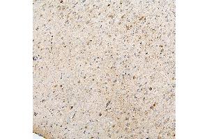 IHC analysis of MTR using anti-MTR antibody (ABIN7602599).