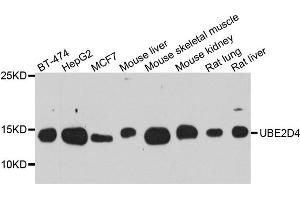 Western blot analysis of extract of various cells, using UBE2D4 antibody. (UBE2D4 抗体)