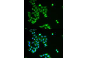 Immunofluorescence analysis of U2OS cell using PJA2 antibody. (PJA2 抗体)