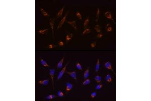 Immunofluorescence analysis of HeLa cells using [KO Validated] SLC25/ Rabbit mAb (ABIN7270428) at dilution of 1:100 (40x lens). (SLC25A4 抗体)