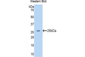 Western blot analysis of the recombinant protein. (PYGL 抗体  (AA 73-267))