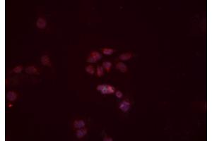 ABIN6277442 staining Hela cells by IF/ICC. (TRIM63 抗体  (N-Term))