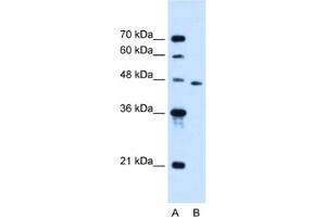Western Blotting (WB) image for anti-Solute Carrier Family 16, Member 12 (Monocarboxylic Acid Transporter 12) (SLC16A12) antibody (ABIN2462789) (SLC16A12 抗体)