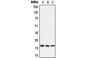 Western blot analysis of TNF beta expression in HeLa (A), Human tonsil (B), Human lymph node (C) whole cell lysates. (LTA 抗体  (Center))
