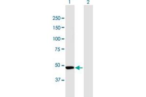 Western Blot analysis of CPEB1 expression in transfected 293T cell line by CPEB1 MaxPab polyclonal antibody. (CPEB1 抗体  (AA 1-486))