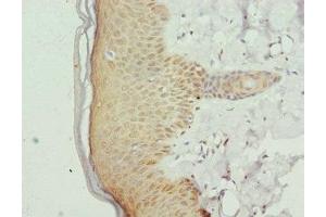 Immunohistochemistry of paraffin-embedded human skin tissue using ABIN7153413 at dilution of 1:100 (GABPB1 抗体  (AA 231-395))
