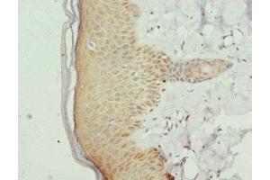 Immunohistochemistry of paraffin-embedded human skin tissue using ABIN7153413 at dilution of 1:100