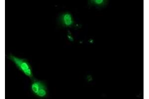 Immunofluorescence (IF) image for anti-EPM2A (Laforin) Interacting Protein 1 (EPM2AIP1) antibody (ABIN1498042) (EPM2AIP1 抗体)