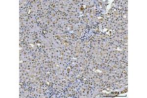 IHC analysis of HOXC4 using anti-HOXC4 antibody (ABIN7603059). (HOXC4 抗体  (Middle Region))