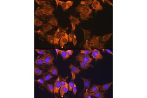 Immunofluorescence analysis of C6 cells using CDV3 Rabbit pAb (ABIN7266240) at dilution of 1:100. (CDV3 抗体)