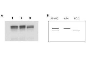 Western blot using  Affinity Purified anti-MCM2 antibody shows detection of both phosphorylated and unphosphorylated MCM2 present in nuclear extracts from elutriated human cells (MO59K/K562). (MCM2 抗体  (AA 21-31))