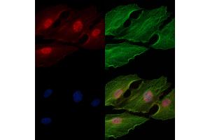 Phospho-Casein Kinase 1 alpha (Tyr294) Antibody staining A549 cells(heat shock treatment) by IF/ICC. (CSNK1A1 抗体  (pTyr294))
