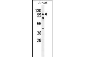 CWC22 Antibody (N-term) (ABIN654743 and ABIN2844428) western blot analysis in Jurkat cell line lysates (35 μg/lane). (CWC22 抗体  (N-Term))