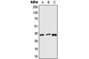 Western blot analysis of ALX3 expression in HeLa (A), NIH3T3 (B), rat brain (C) whole cell lysates. (ALX3 抗体  (Center))