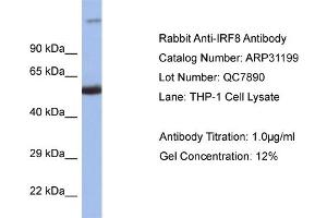 WB Suggested Anti-IRF8 Antibody   Titration: 1. (IRF8 抗体  (C-Term))