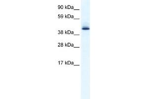 Western Blotting (WB) image for anti-Apoptosis Antagonizing Transcription Factor (AATF) (N-Term) antibody (ABIN2777467)