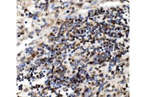 IHC analysis of NOLA1/GAR1 using anti-NOLA1/GAR1 antibody (ABIN7602076).