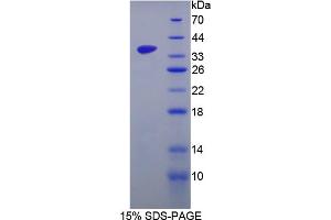Image no. 1 for serine/arginine-Rich Protein Specific Kinase 3 (SRPK3) (AA 220-506) protein (His tag) (ABIN6238317) (SRPK3 Protein (AA 220-506) (His tag))