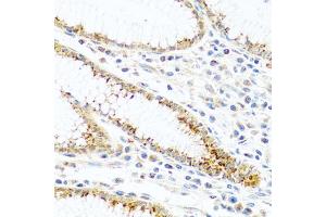 Immunohistochemistry of paraffin-embedded human stomach using FAM3B antibody (ABIN5970440) at dilution of 1/100 (40x lens). (FAM3B 抗体)