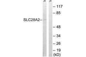 Western blot analysis of extracts from Jurkat cells, using SLC28A2 Antibody.