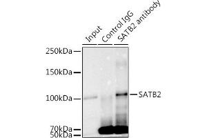 Immunoprecipitation analysis of 300 μg extracts of K-562 cells using 3 μg S antibody (ABIN7270152). (SATB2 抗体)