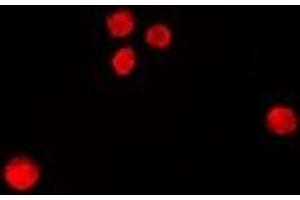 Immunofluorescent analysis of RbAp46 staining in MCF7 cells. (RBBP7 抗体)