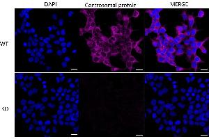 Immunocytochemical staining of HeLa cells using Centrosomal protein 55 antibody (ABIN7798025), 1:1,000), Top panel: wild-type (WT), Bottom panal: Centrosomal protein 55 shRNA knockdown (KD).