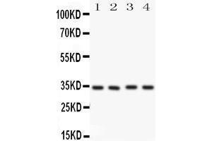 Western Blotting (WB) image for anti-Caspase 7, Apoptosis-Related Cysteine Peptidase (CASP7) (AA 237-255), (Middle Region) antibody (ABIN3043217)