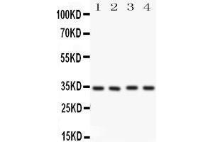 Anti-Caspase-7(P11) antibody, Western blotting All lanes: Anti CASP7(p11)  at 0. (Caspase 7 抗体  (Middle Region))