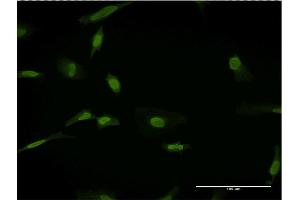 Immunofluorescence (IF) image for anti-Solute Carrier Family 11 (Proton-Coupled Divalent Metal Ion Transporters), Member 2 (SLC11A2) (AA 1-65) antibody (ABIN518431)