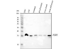 Western blot analysis of AGR2 using anti-AGR2 antibody (ABIN5518726).