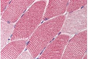 Human Skeletal Muscle (formalin-fixed, paraffin-embedded) stained with TSC1 antibody ABIN214539 at 2. (TSC1 抗体)