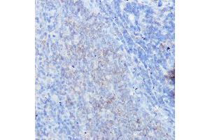 Immunohistochemistry of paraffin-embedded rat spleen using IFNGR1 Rabbit pAb (ABIN6127566, ABIN6142197, ABIN6142198 and ABIN6221420) at dilution of 1:100 (40x lens). (IFNGR1 抗体  (AA 270-489))