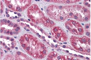 Immunohistochemistry (IHC) image for anti-Transient Receptor Potential Cation Channel, Subfamily C, Member 4 (TRPC4) (Internal Region) antibody (ABIN570934)