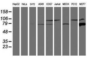 Image no. 5 for anti-Calpain 9 (CAPN9) antibody (ABIN1497092)