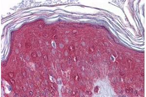 Human Skin: Formalin-Fixed, Paraffin-Embedded (FFPE) (FGFR1 抗体  (N-Term))