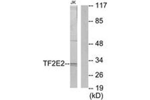 Western Blotting (WB) image for anti-General Transcription Factor IIE, Polypeptide 2 (GTF2E2) (AA 151-200) antibody (ABIN2889444) (GTF2E2 抗体  (AA 151-200))