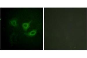 Immunofluorescence analysis of HuvEc cells, using p70 S6 Kinase (Phospho-Thr389) Antibody.