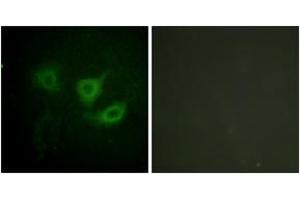 Immunofluorescence analysis of HuvEc cells, using p70 S6 Kinase (Phospho-Thr389) Antibody.