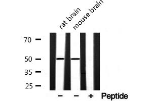 Western blot analysis of extracts of various samples,using akt1/3 Antibody. (AKT1/3 抗体)