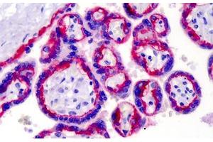 Human Placenta: Formalin-Fixed, Paraffin-Embedded (FFPE) (Integrin beta 4 抗体)