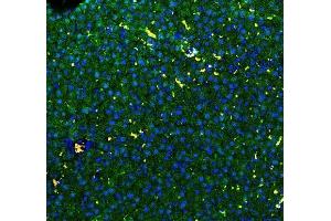anti-Glutathione S-Transferase alpha 1 (GSTA1) (AA 63-97), (N-Term) antibody