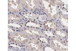 ABIN6267405 at 1/200 staining human kidney tissue sections by IHC-P. (Stathmin 1 抗体  (pSer25))